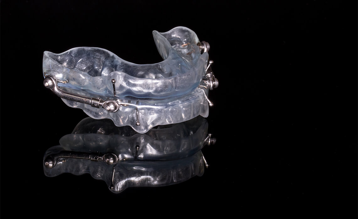 3 Commonly Asked questions about Oral Appliance Therapy