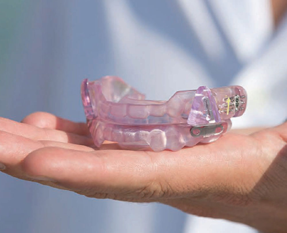 How Oral Appliance Therapy Can Help